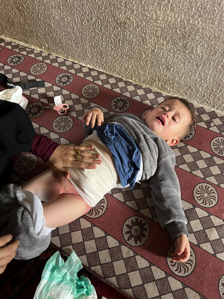 Association Amani - AMANI va prendre en charge l’intervention chirurgicale de l’enfant HANI de la bande de Gaza... - IMG 20250526 WA0002